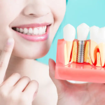 Revitalize Your Smile With Dental Implants